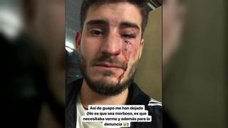 Un joven sufre una salvaje agresión homófoba en el metro de Barcelona