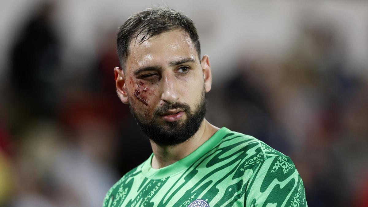 Así quedó Donnarumma tras una entrada criminal en el PSG - Mónaco