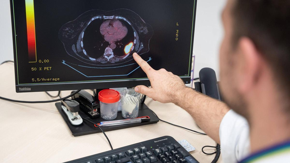 一部の初期腫瘍は生き残り、他の腫瘍は体によって除去される理由を科学者が発見