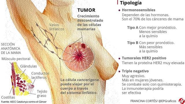 Gráfico cáncer de mama
