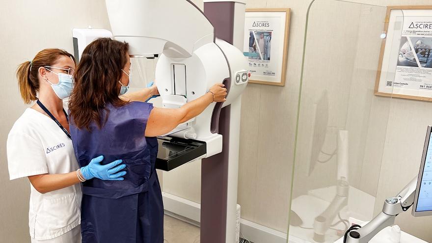 Una paciente se somete a una mamografía en Ascires Castelló.