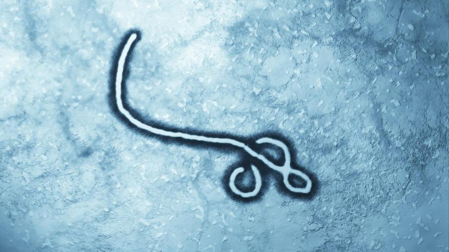 Imagen del virus del ébola.