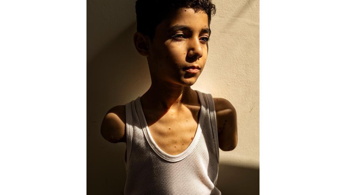 La fotógrafa palestina Samar Abu Elouf ganó este jueves el premio Foto del Año del World Press Photo por una imagen de un niño de 9 años de Gaza que perdió ambos brazos en un ataque israelí.