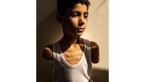 La fotógrafa palestina Samar Abu Elouf ganó este jueves el premio Foto del Año del World Press Photo por una imagen de un niño de 9 años de Gaza que perdió ambos brazos en un ataque israelí en marzo de 2024 y que fue evacuado a Doha para recibir tratamiento.