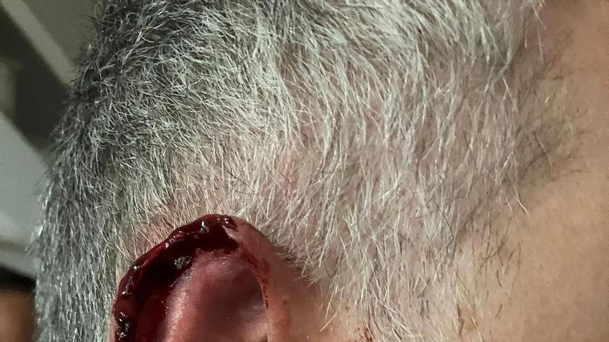 Un ocupa muerde y arranca parte de la oreja a un policía de València