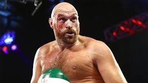 Tyson Fury, boxeador, 57 millones de dólares