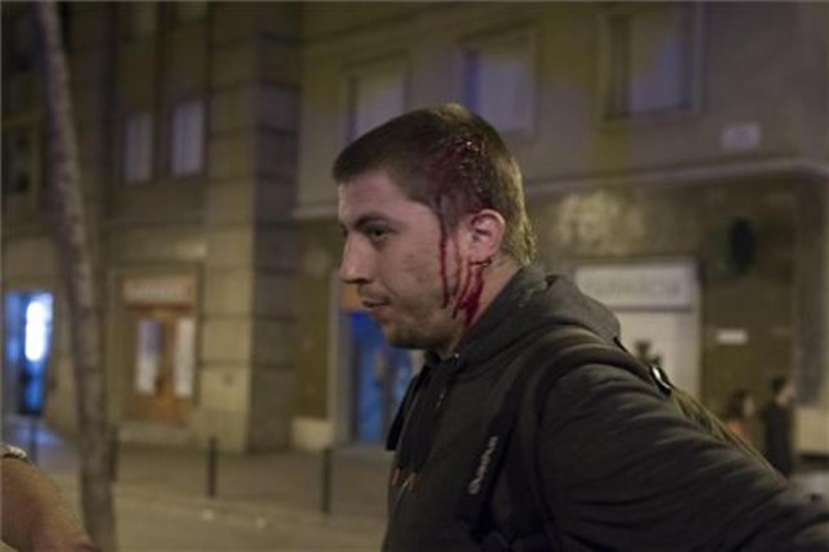 Persona ferida després dels disturbis de Can Vies al barri de Sants.