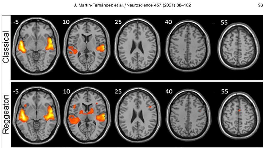 El reguetón provoca mayor actividad cerebral que escuchar música clásica o folclore