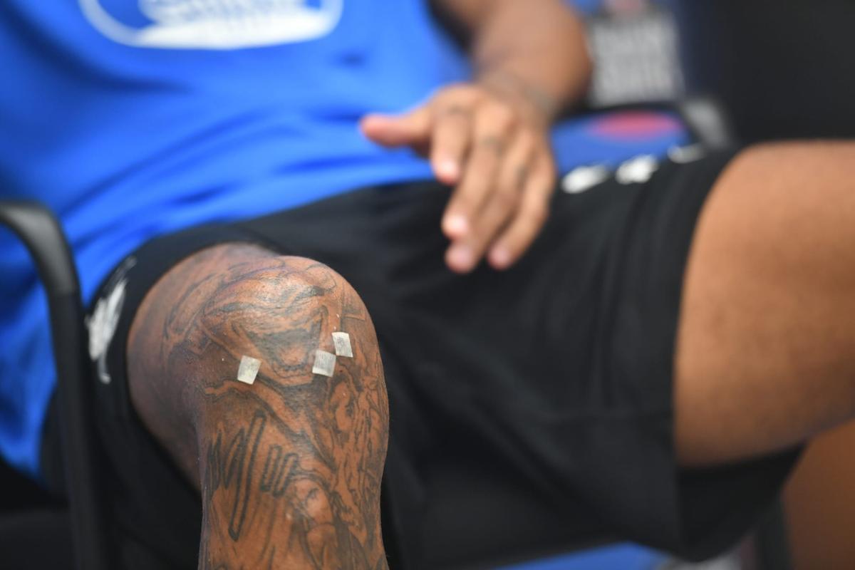 Las cicatrices de la rodilla de Aubameyang
