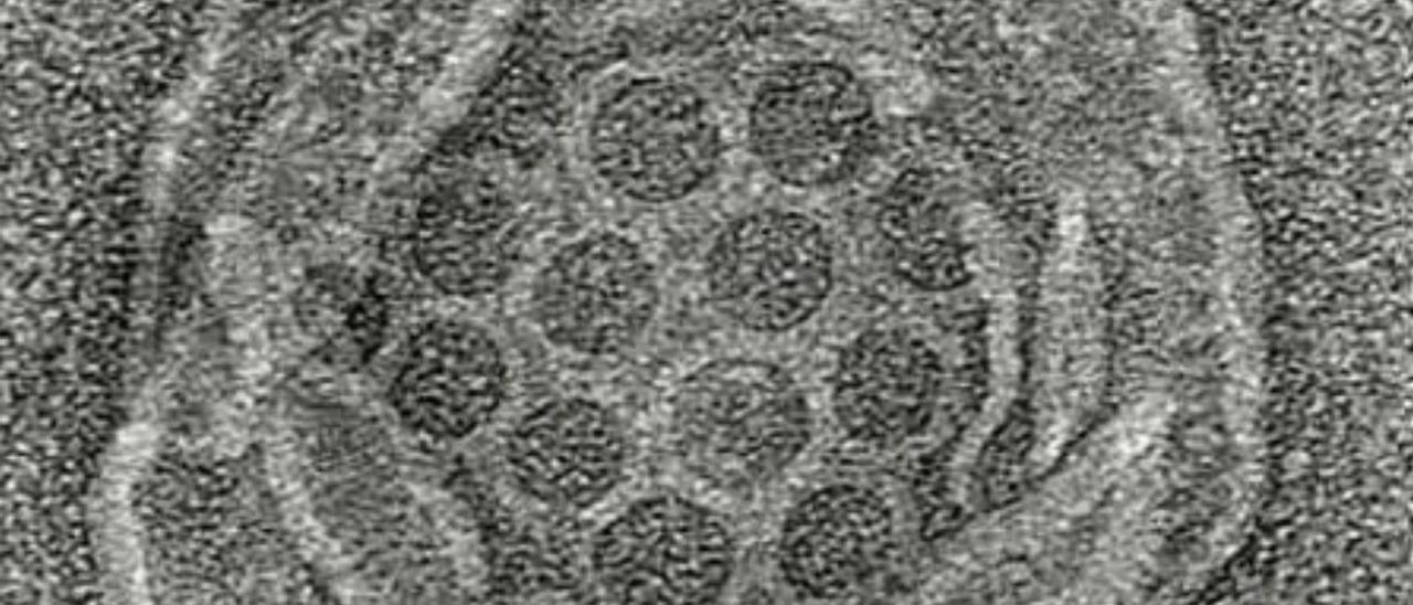 Imagen de microscopio electrónico de los poros en la bacteria
Runella. | SCIENCE