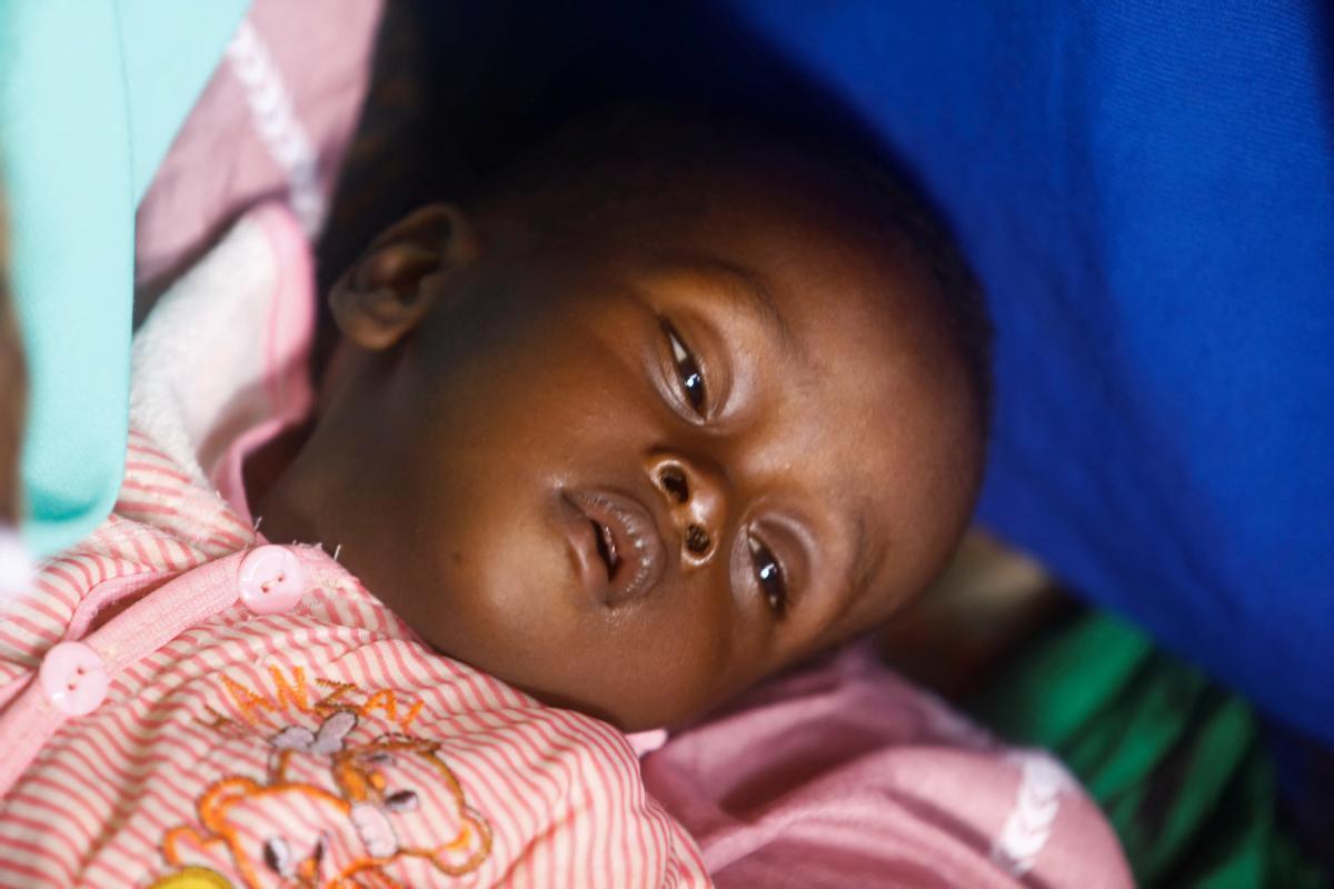 Ayana Dam, un niño somalí es visto en el hospital de alimentación MCH después de que huyeron de la severa sequía.