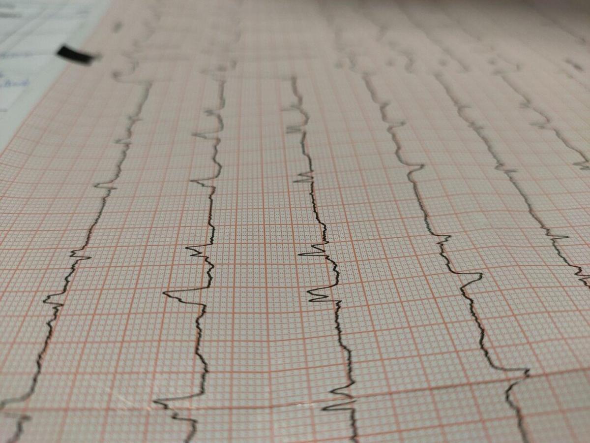 Insuficiencia cardiaca durante la pandemia: Así le afectó la COVID-19