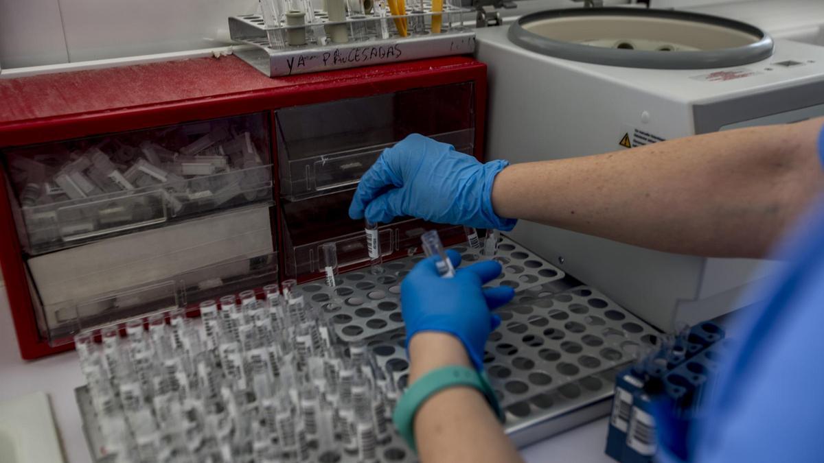 Manejo de muestras de covid en un laboratorio de Microbiología de la provincia