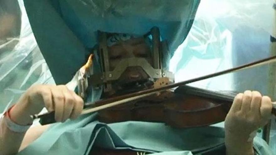 Una mujer toca el violín mientras en plena operación de cerebro