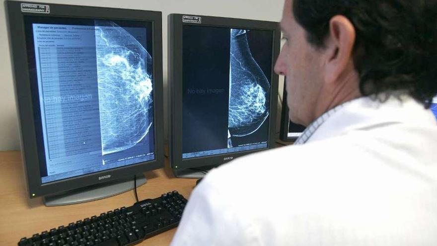 Una de cada seis coruñesas no se somete a las mamografías periódicas del Sergas