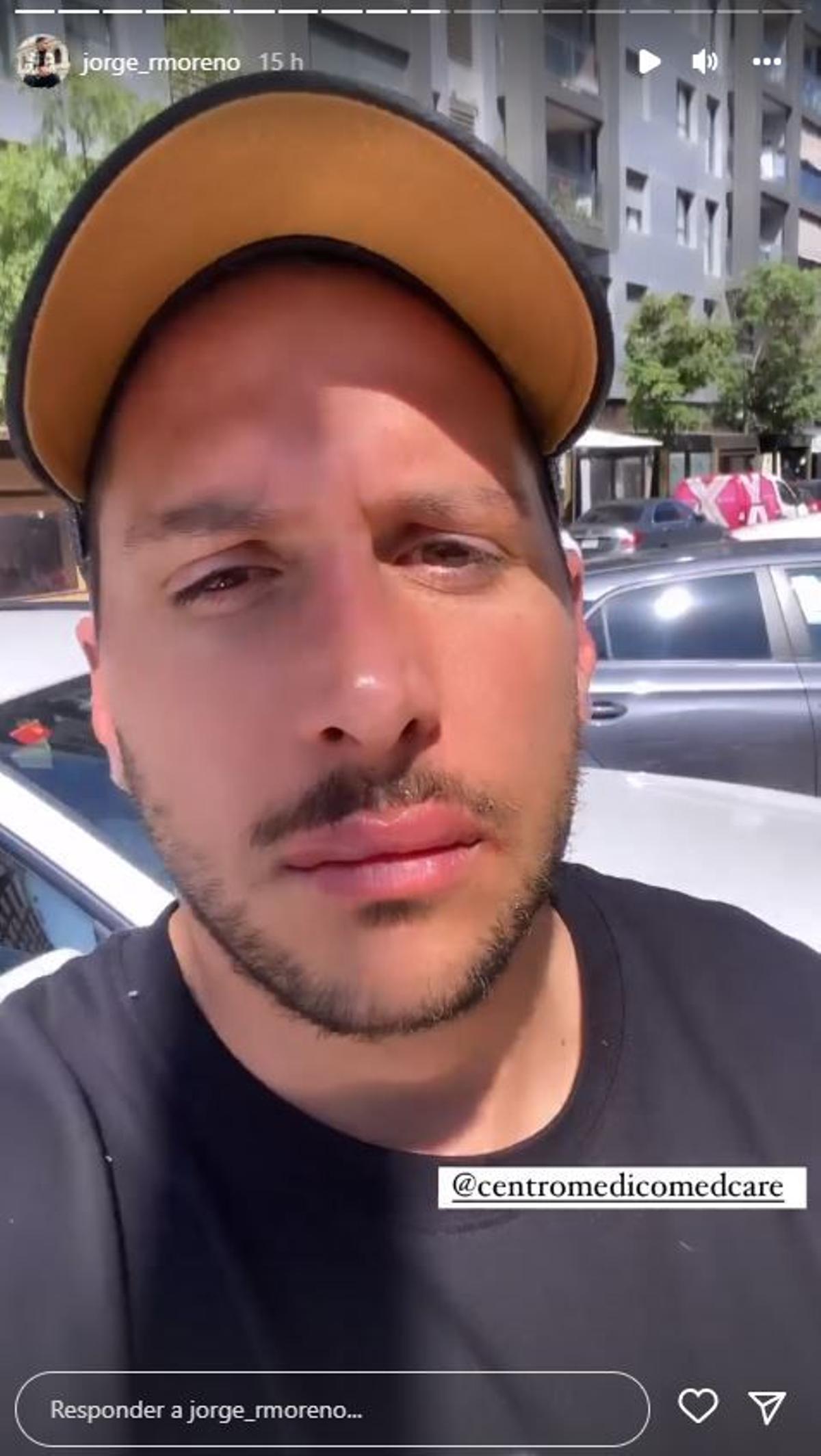 Jorge Moreno, pareja de Yolanda ('Gh') se pincha los labios