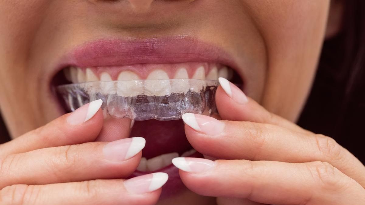 Los dentistas alertan sobre la compra de artículos por redes