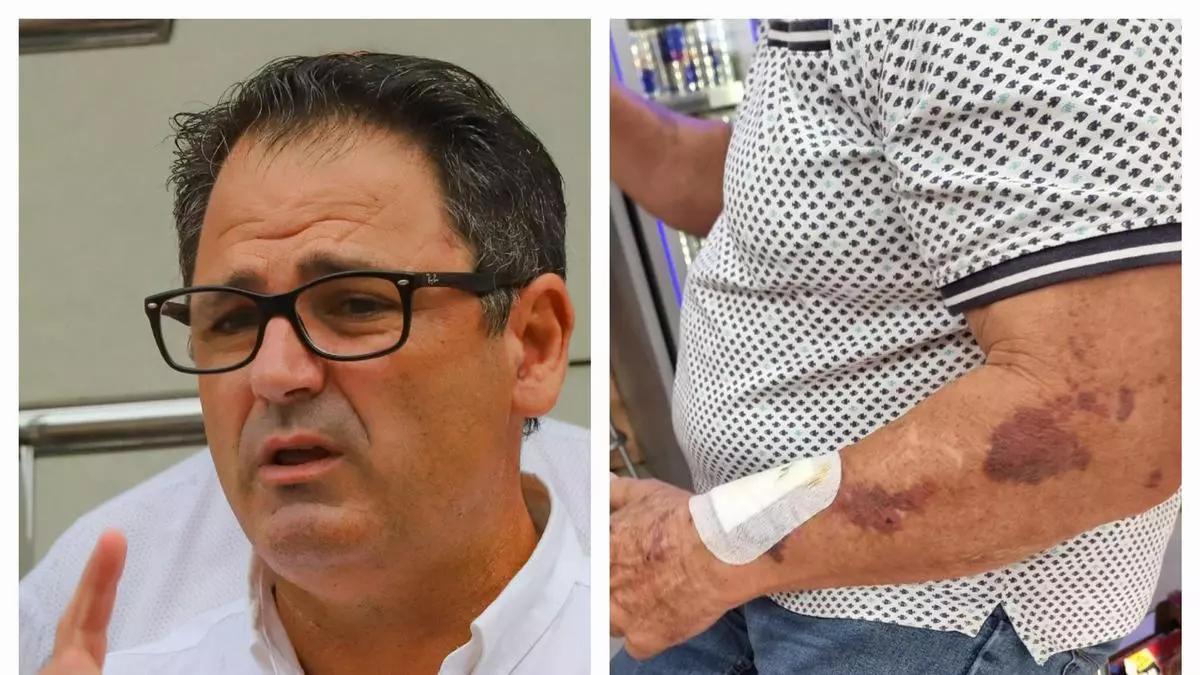 Joaquín Hernández, a la izquierda, y el vecino que denunció al alcalde por agresión