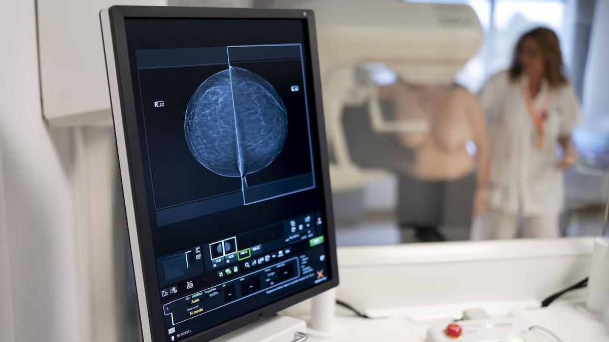 Una tècnica especialista en radiodiagnòstic fa una mamografia a una dona que participa en el programa de cribratge o detecció precoç del càncer de mama a l’ICO. | FERRAN NADEU