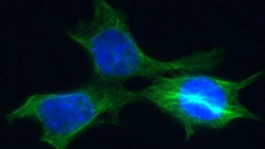 Imatge de cèl·lules de càncer de mama derivades d&#039;un tumor de ratolí.