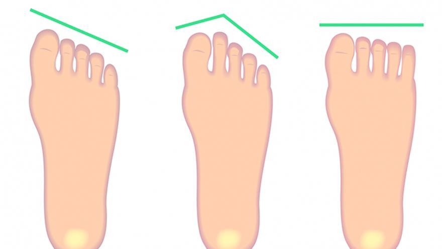 Tipos de pie por la longitud de los dedos.