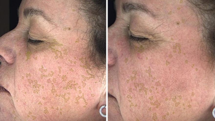 El laboratorio malagueño Frankie’s Labs logra una nominación internacional para su sérum quitamanchas facial