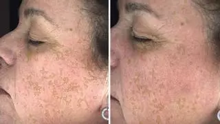 El laboratorio malagueño Frankie’s Labs logra una nominación internacional para su sérum quitamanchas facial
