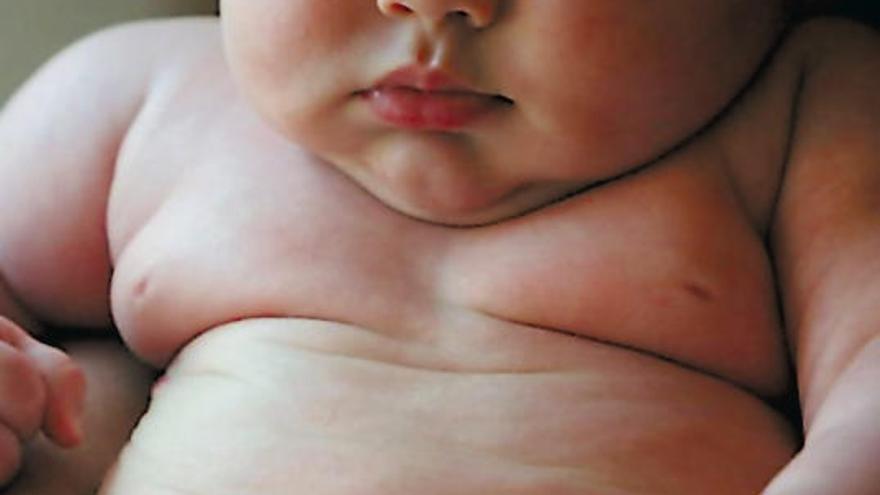 Imagen de un bebé con sobrepeso.