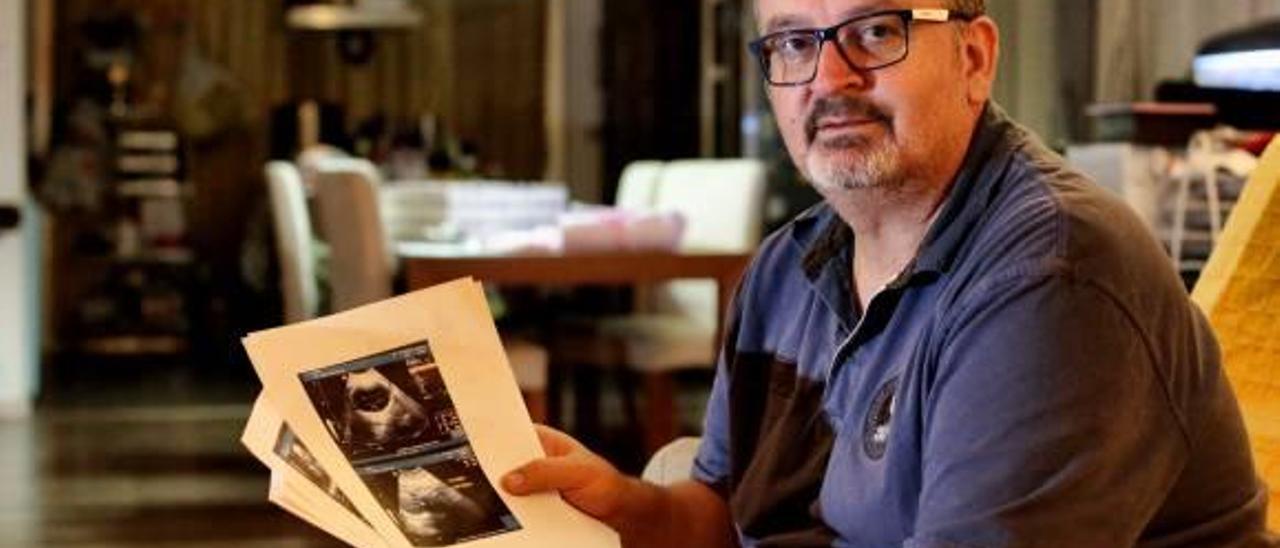 Lorenzo Medina observa una de las ecografías de su hija que, paulatinamente, han recibido en estos meses para seguir el proceso de gestación.