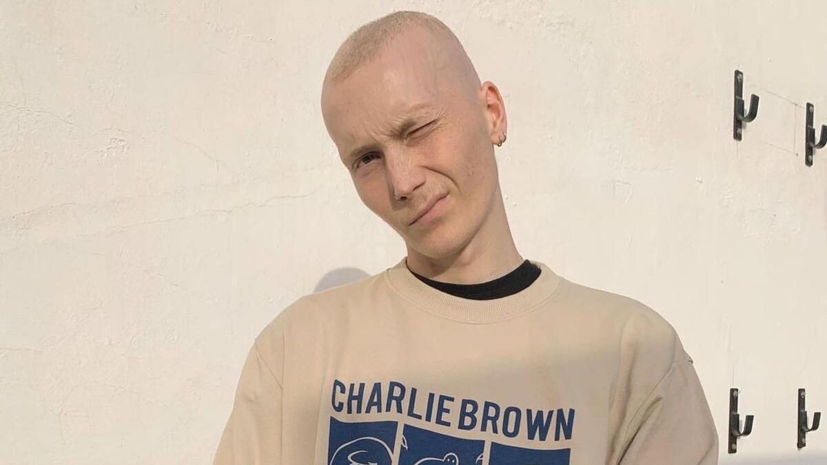 Charlie, el joven influencer que luchó 4 años contra el cáncer.