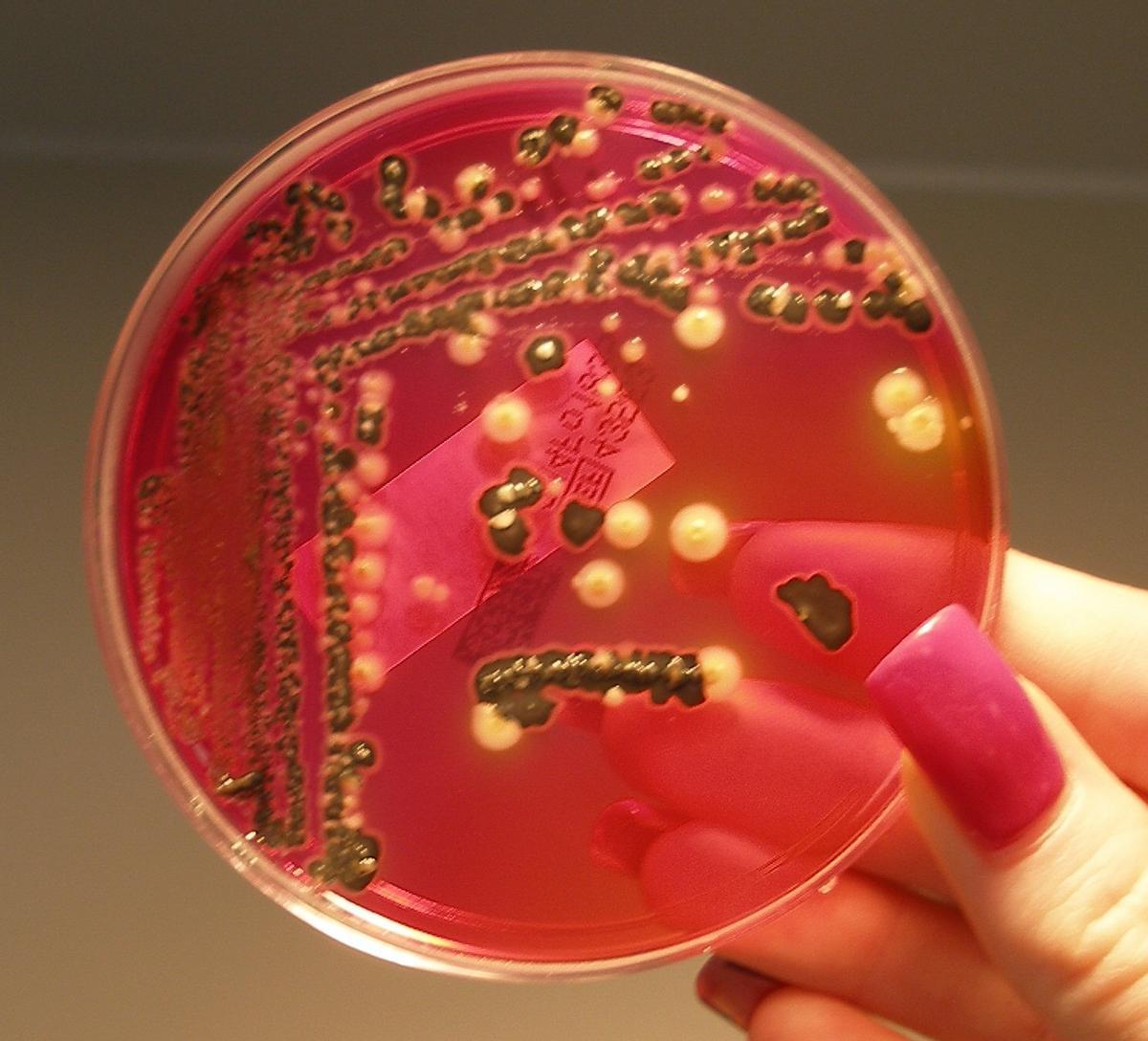 Bacteria de Salmonella creciendo en agar
