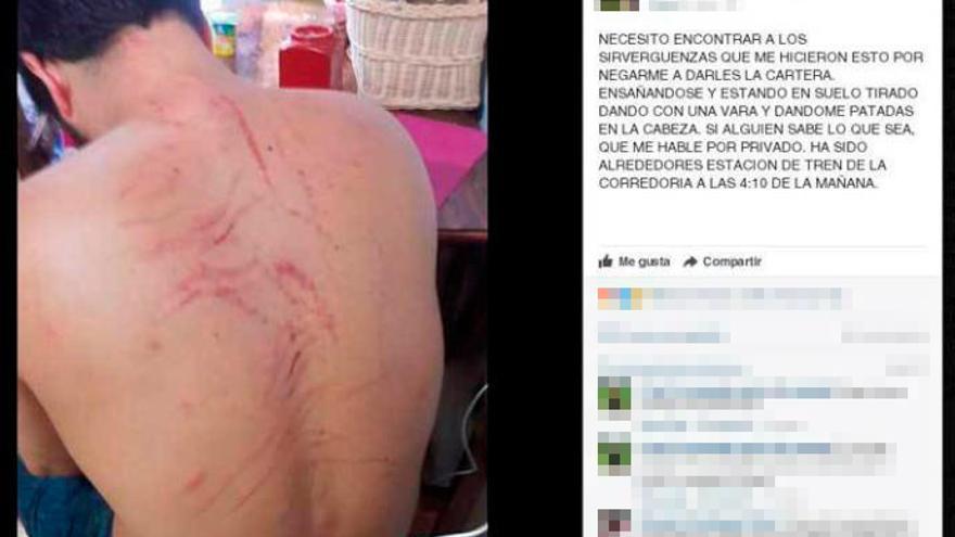 La fotografía colgada en una red social por el joven agredido en La Corredoria.