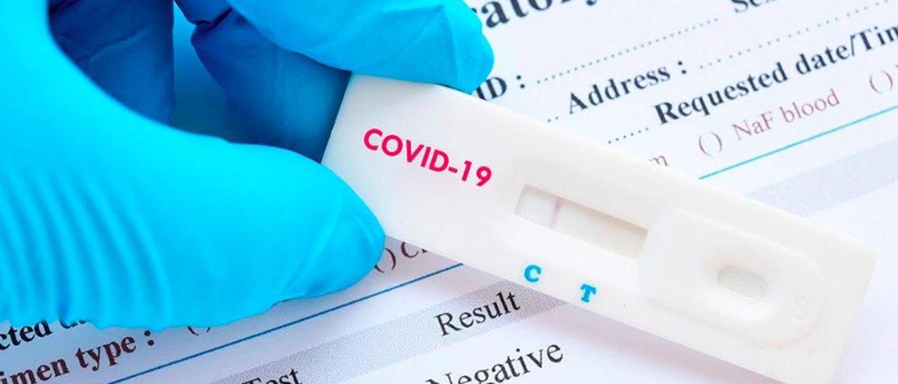 Rápidos y poco fiables o efectivos pero caros y lentos: el test perfecto del coronavirus no existe