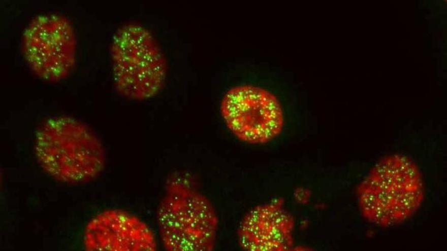 L’Hospital del Mar identifica una nova estratègia contra el càncer de pàncrees que ataca les cèl·lules tumorals i activa el sistema immunitari