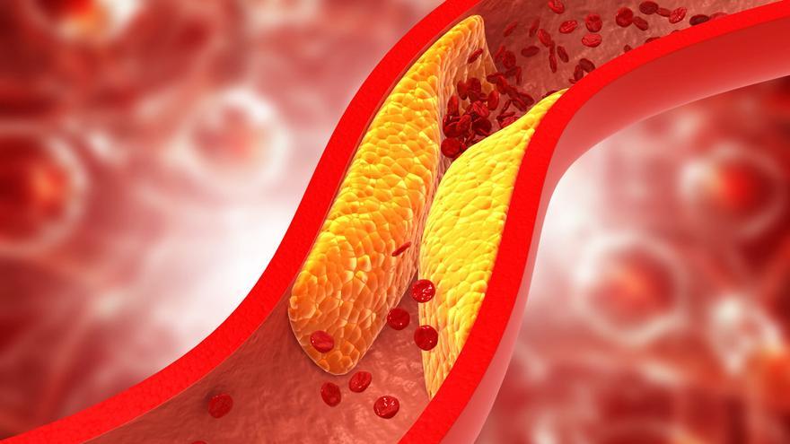 Colesterol, todo lo que debes saber: Estos son sus riesgos y su repercusión en nuestro organismo