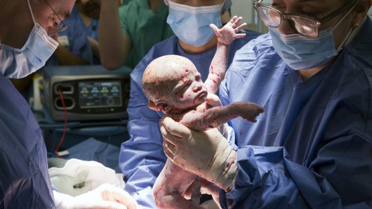 Un bebé segundos después de nacer en un hospital gallego.