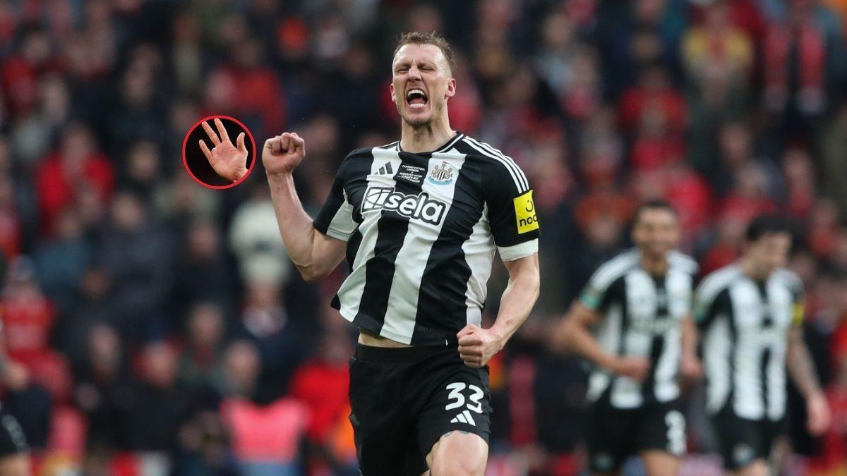 Dan Burn, futbolista del Newcastle United