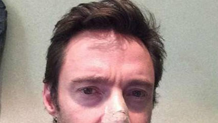 Hugh Jackman revela que ha sufrido un leve carcinoma de piel