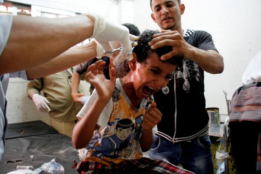 Un chico reacciona cuando los médicos lo atienden tras resutar herido durante enfrentamientos entre combatientes pro-gobierno y combatientes Houthi en la ciudad suroeste de Taiz, Yemen. REUTERS.