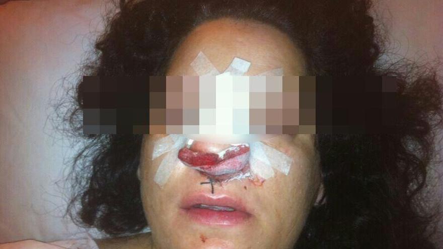Imagen de la mujer que denunció trato cruel por parte de la Policía en Córdoba.