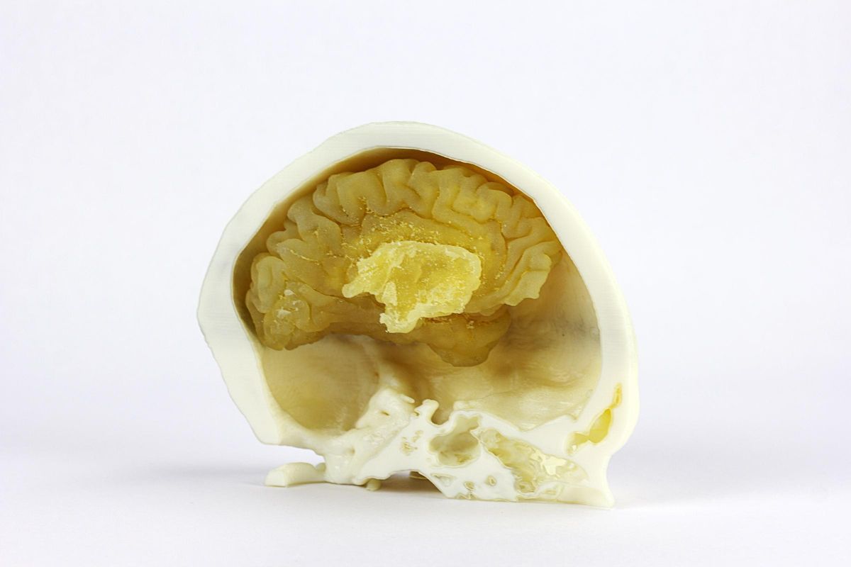 Un biomodelo 3D de un cerebro.