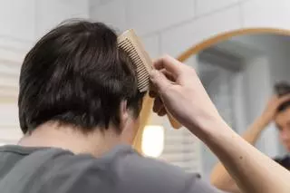 Cómo prevenir y eliminar la caspa de tu cuero cabelludo