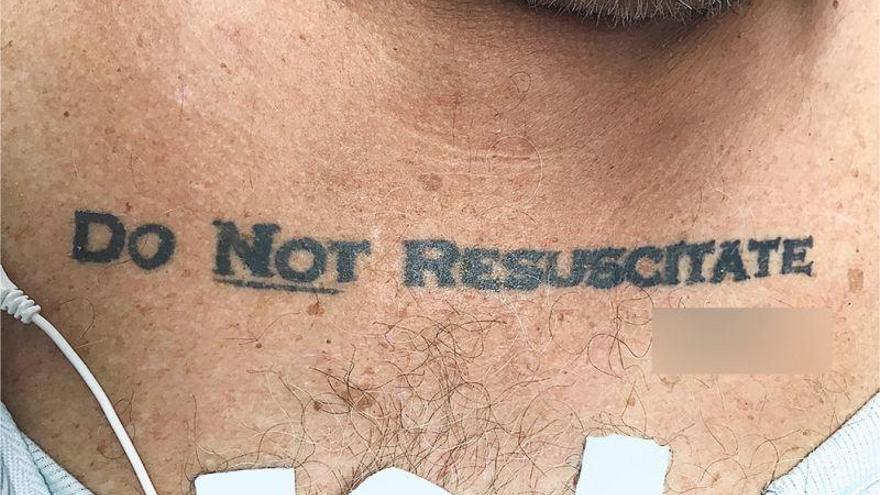 Un tatuaje de &#039;no resucitar&#039; abre un debate médico