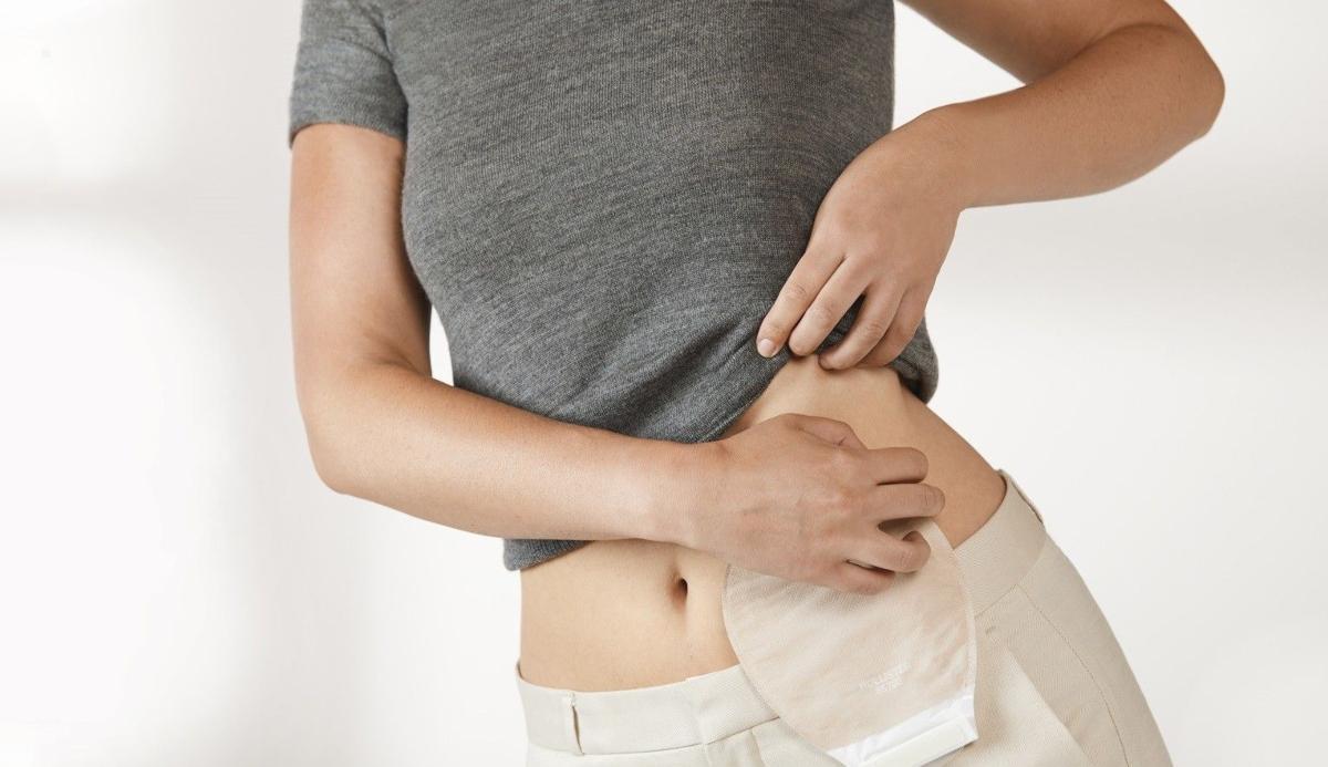 Pacientes ostomizados: ¿sabes qué es y por qué necesitan baños adaptados?