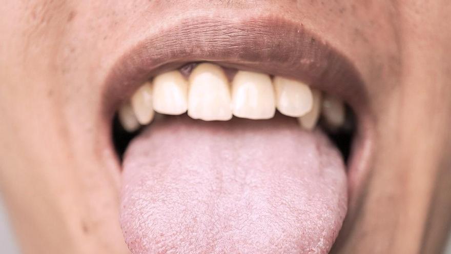 ¿Cuánto hace que no miras tu lengua? Puede revelar más sobre tu salud de lo que imaginas