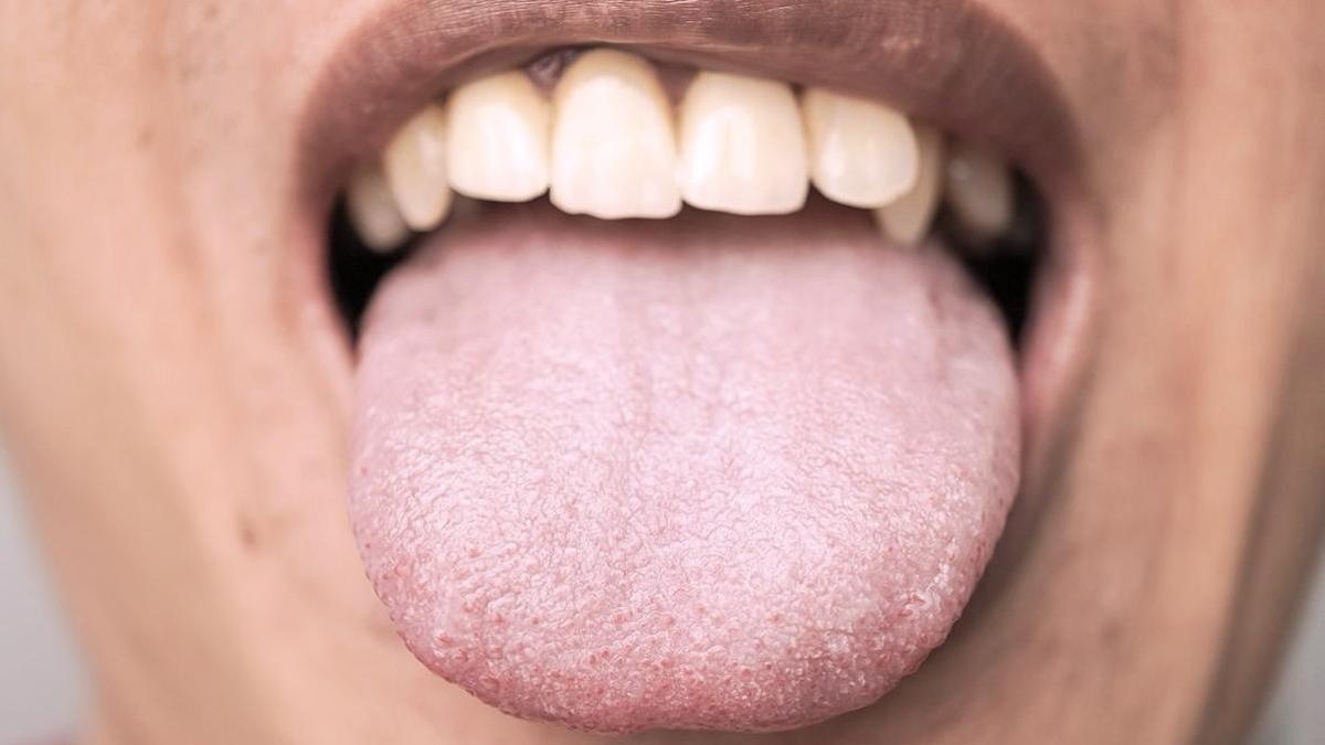 ¿Cuánto hace que no miras tu lengua? Puede revelar más sobre tu salud de lo que imaginas