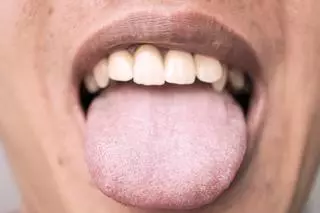 ¿Cuánto hace que no miras tu lengua? Puede revelar más sobre tu salud de lo que imaginas