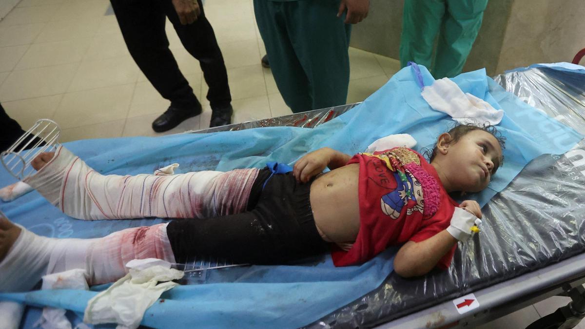 Un niño palestino herido en un bombardeo israelí descansa en una camilla en el hospital de Jan Yunis, este lunes.