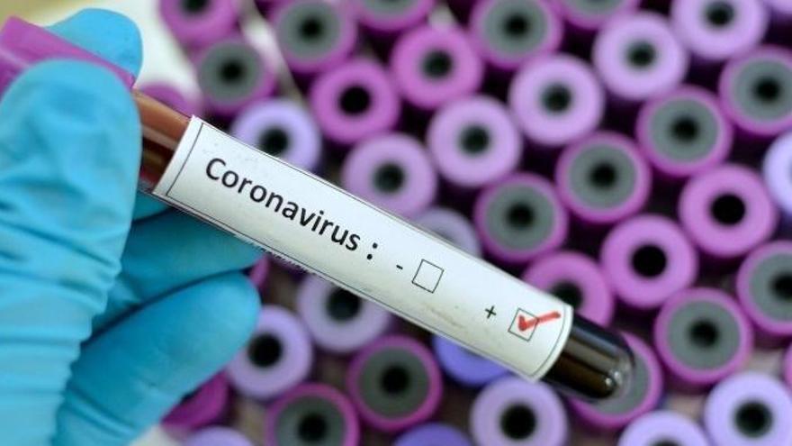 No hi ha capacitat per fer tests de coronavirus a tots els casos sospitosos