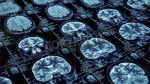 Imágenes de escáner de un cerebro. /